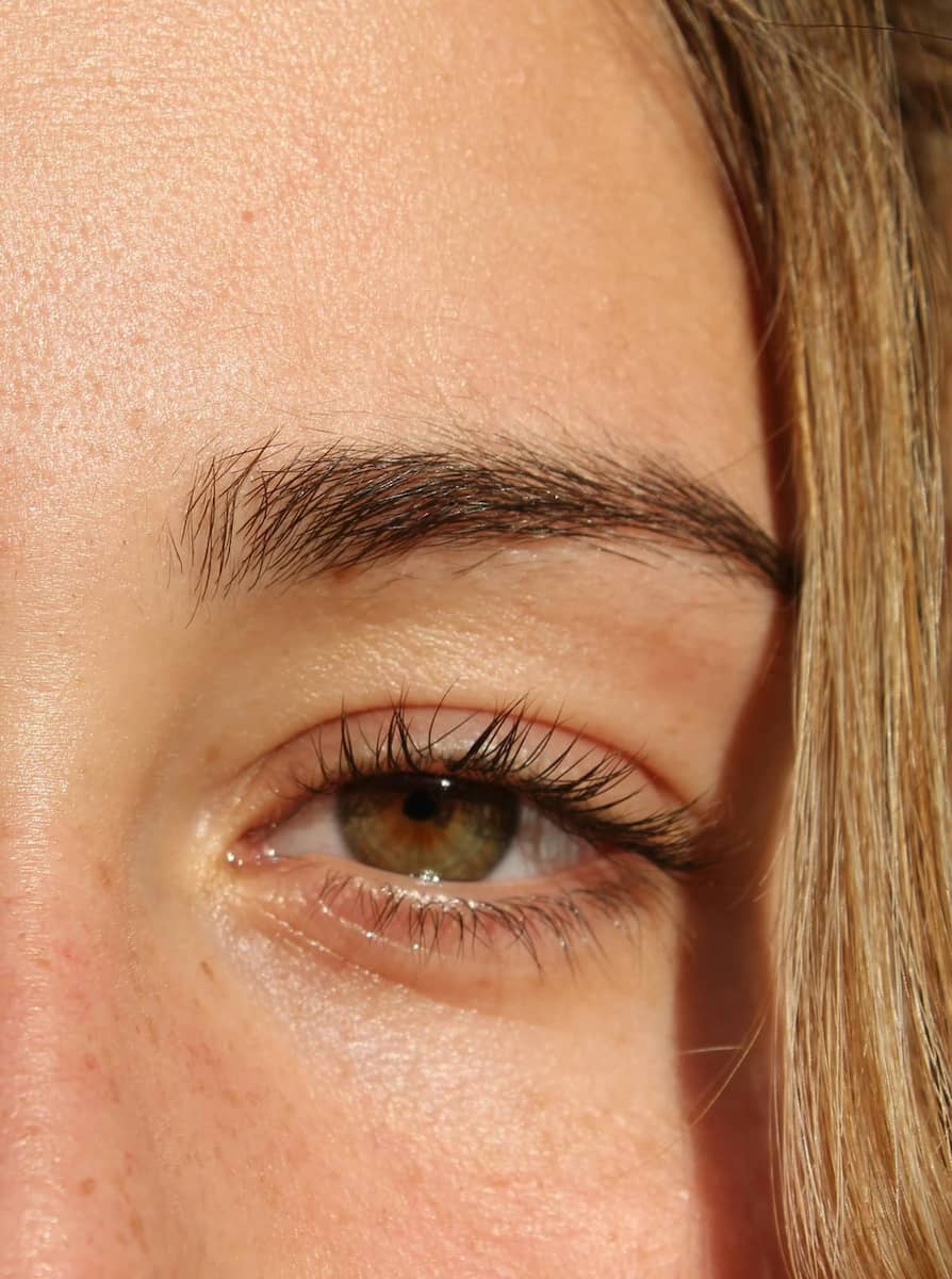 Professional Pigment Removal by Brenda Cazares in Brenink